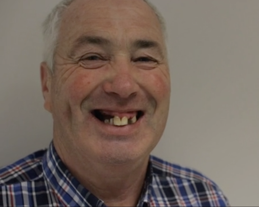 Smile in a day - robbie gannon - before